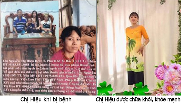 Lương y Nguyễn Trần Chuyển - Bàn tay vàng chữa các bệnh u, hạch